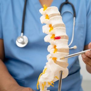 Hernia lumbar, ¿causa o consecuencia?